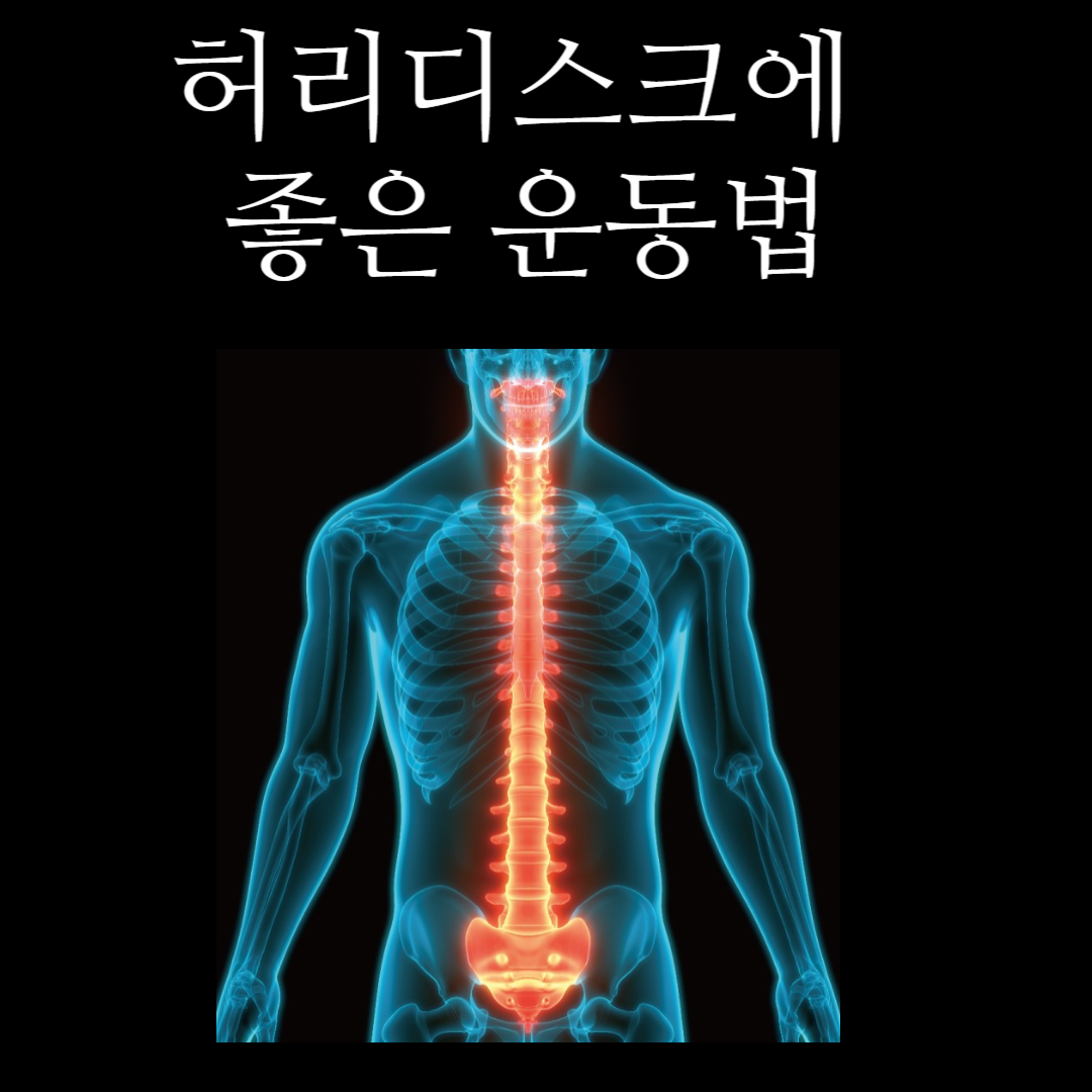 허리디스크에 좋은 운동법